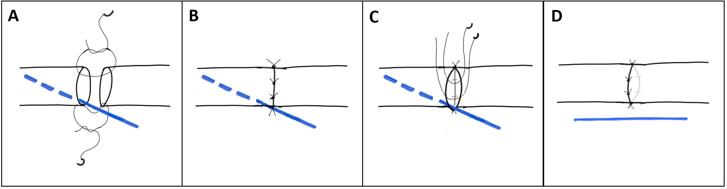 Figure 2 .PNG